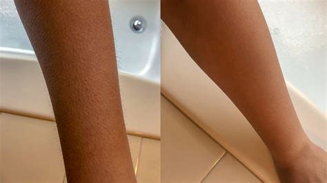 Shaving Arms: Pros & Cons, Side Effects, and How to Do It Properly